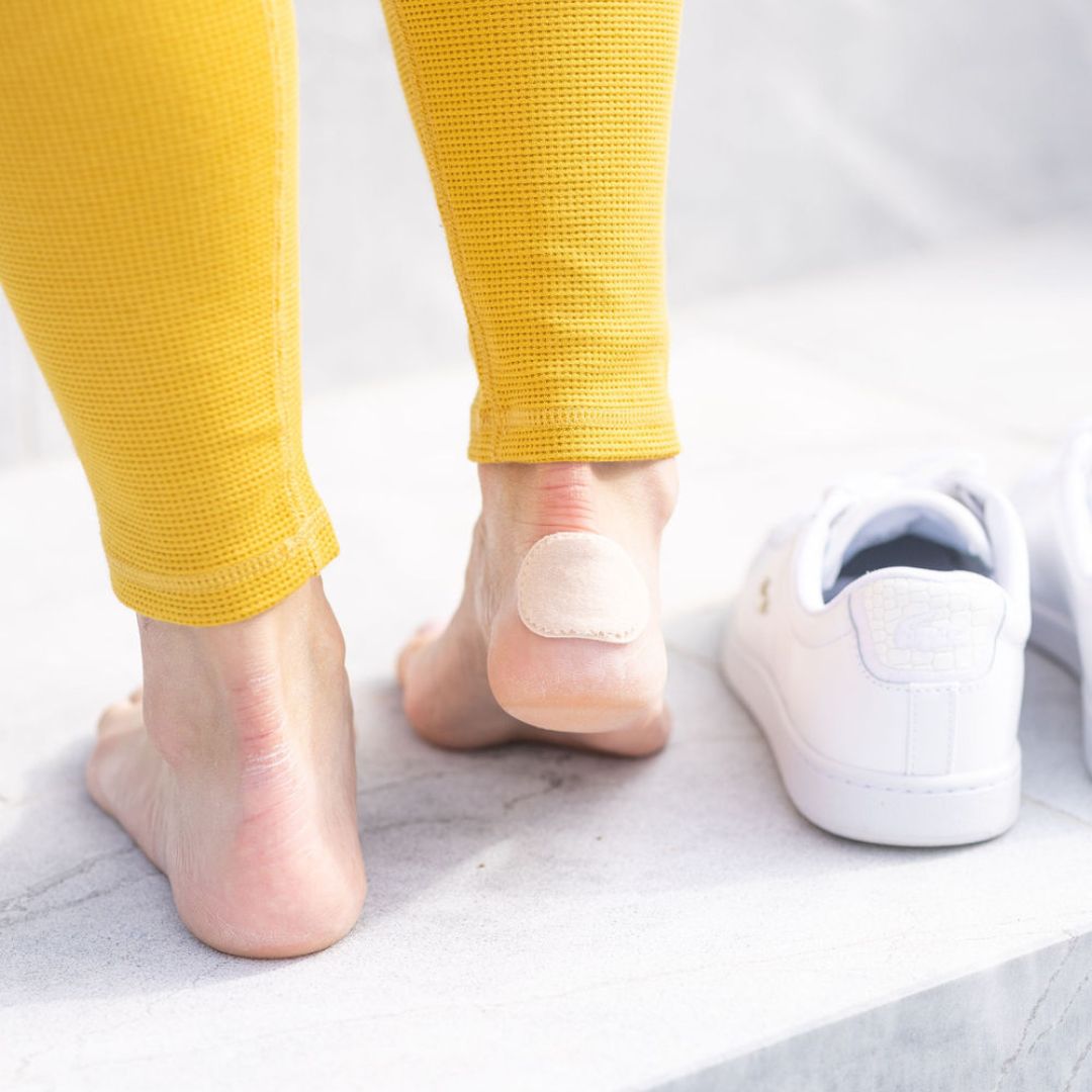 Podiatrist-Recommended Solutions for Blisters